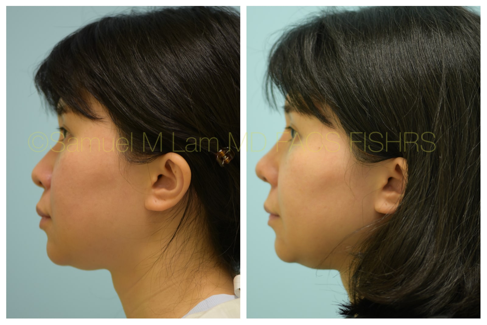 Expert on the Ethnic and Asian Face